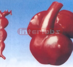 HUMAN EXPANSION DEVELOPMENT MODEL OF THE HEART ARTERY