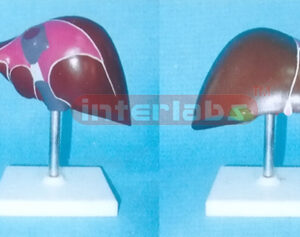 HUMAN DIDACTICALLY PAINTED LIVER