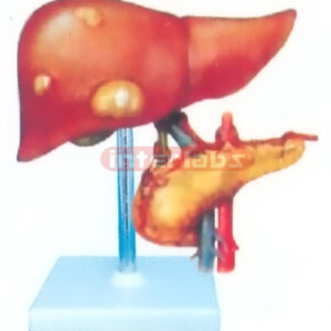 CANCER DISEASE LIVER AND PANCREAS MODEL WITH DESCRIPTION PLATE