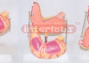 BIG STOMACH ANATOMICAL & ENLARGED MODEL