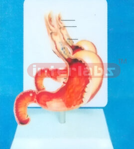 DESK TYPE HUMAN COMMON PATHOLOGIES OF STOMACH MODEL WITH DESCRIPTION PLATE