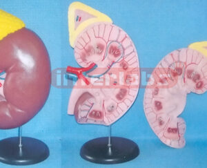 SUPER KIDNEY ANATOMICAL ENLARGED MODEL (2 PCS)