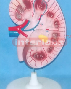 SUPER KIDNEY ANATOMICAL ENLARGED MODEL