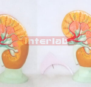 BIG ANATOMICAL ENLARGED KIDNEY MODEL WITH DISSECTABLE ADRENAL GLAND & BASE