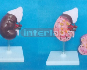 MIDDLE KIDNEY WITH ADRENAL GLAND (2 PARTS) MAGNIFIED ON BASE 14.5 cm LONG