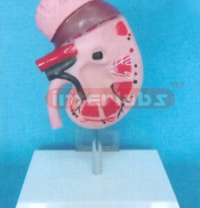 MIDDLE ANATOMICAL KIDNEY MODEL WITH ADRENAL GLAND