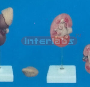 NATURAL RIGHT KIDNEY WITH REMOVABLE ADRENAL GLAND 3 PCS 8.5 CM LONG