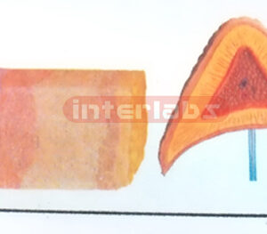 BIG ADRENAL GLAND ANATOMICAL AND ENLARGED MODEL
