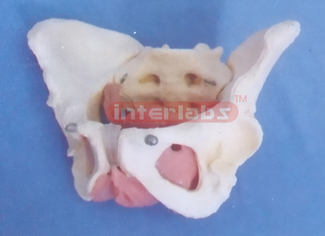 FEMALE MUSCULAR& INNER ORG ENS IN PELVIS MODEL A TYPE
