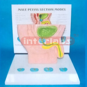 HUMAN MALE HEALTH DISEASE COMPOSITION MODEL OF GENITAL ORGANS BLADDER, PROSTATE AND URETHRA