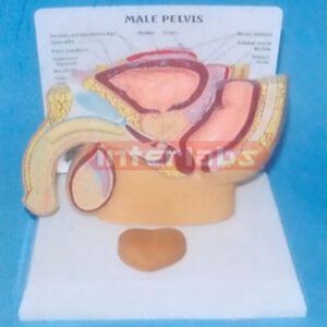 DESK-TYPE, HUMAN MALE HEALTH PELVIS AND DISEASED PROSTATE MODEL FOR DEMONSTRATION