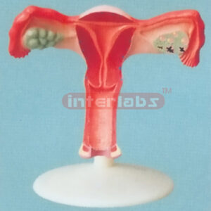 BIG MAGNIFIED UTERUS OBVERSE DISSECT (A TYPE)