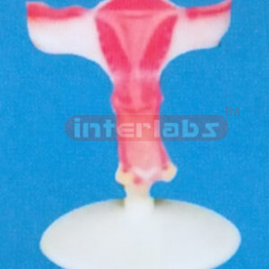 BIG MAGNIFIED UTERUS INVERSE DISSECT (C TYPE)
