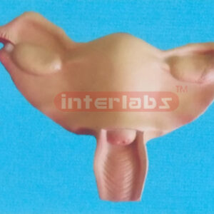 EXTRAUTERINE PREGNANCY POSITIONS MODEL