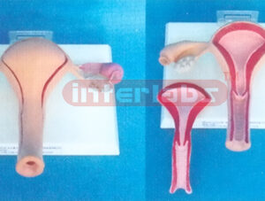 WEST DESK TYPE, ANATHEALTH UTERUS & OVAY WIDESCRIPTION PLATE (2 PCS) W/COVER AND THE LESSER LIPS OF PUDENDUM