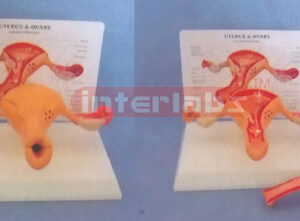 WEST DESK TYPE, COMMON PATHOLOGIES UTERUS & OVARY WIDESCRIPTION PLATE (2 PCS) WITH COVER AND THE LESSER LIPS OF PUDENDUM