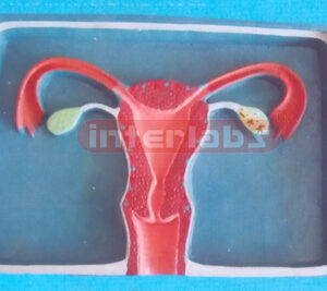 INTRAUTERINE DEVICE (I.U.D.) TRAINER