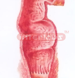 HUMAN HEALTH RECTUM (CORONAL SECTION) MODEL