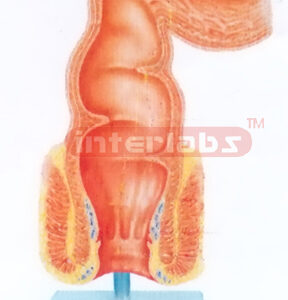 HUMAN HEALTH RECTUM (CORONAL SECTION) MODEL