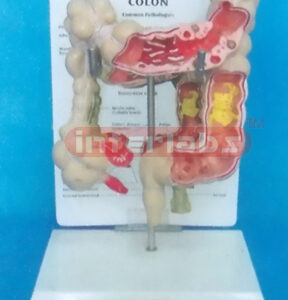 WEST DESK TYPE COMMON PATHOLOGIES OF COLON MODEL WITH DESCRIPTION PLATE