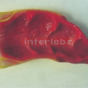 RECTUM INNER CAVITY WITH PLASTIC BASE