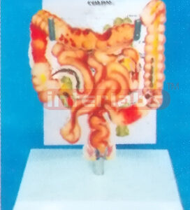 DESK TYPE HUMAN COMMON PATHOLOGIES OF THE INTESTINES SYSTEM WITH DESCRIPTION PLATE