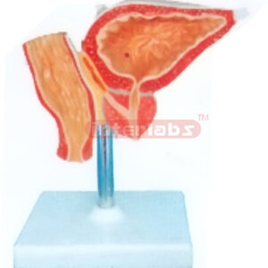 HUMAN GALL BLADDER, PROSTATE AND RECTUM MODEL