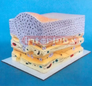 HUMAN SKIN EXPLODED DEMONSTRATION MODEL FOR CANCER CELLS