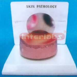 DESKTYPE COMMON PATHOLOGIES MODEL OF ERUPTION SERIES WITH DESCRIPTION PLATE