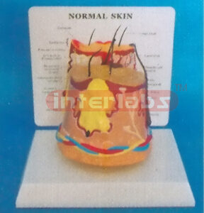 DESK / ROUND TYPE, DISEASE (ACNE) SKIN WITH DESCRIPTION PLATE