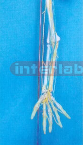 BIG LEFT ARM AND MAIN VEIN, NERVE MODEL