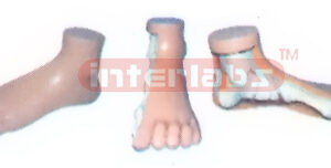 BIG FOOT, NORMAL