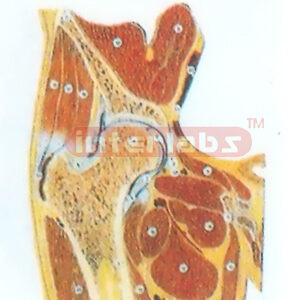 EXPANSION SECTION MODEL THROUGH THE HIP JOINT