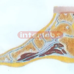 EXPANSION SECTION MODEL THROUGH A NORMAL FOOT