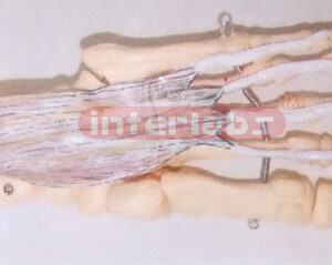 BIG ADULT HUMAN FOOT BONE WITH MUSCLES OF MIDDLE LAYER OF SOLE