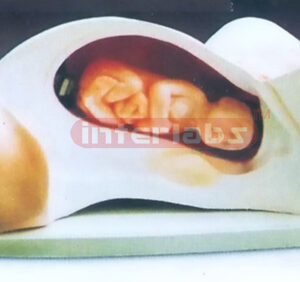 COURSE OF PARTURITION (B TYPE)