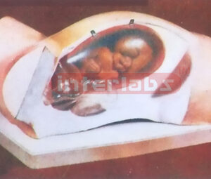 COURSE OF PARTURITION (A TYPE)