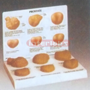 LIFE-SIZE PROSTATE MODEL SET WITH DESCRIPTION PLATE
