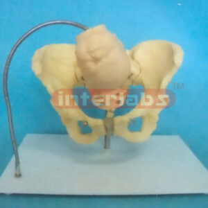 BIRTH DEMONSTRATION MODEL