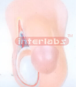 MALE TESTIS ANATOMICAL & ENLARGED MODEL