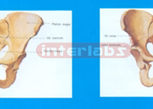 HUMAN FEMALE HEALTH PELVIS COMPARISON MODEL