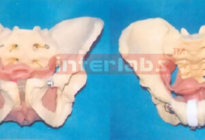 HEALTH PELVIS MODEL OF BOTH FEMALE AND MALE'S REPRODUCTIVE ORGANS