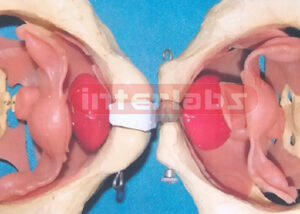 HUMAN FEMALE UNFINE PELVIS MODEL
