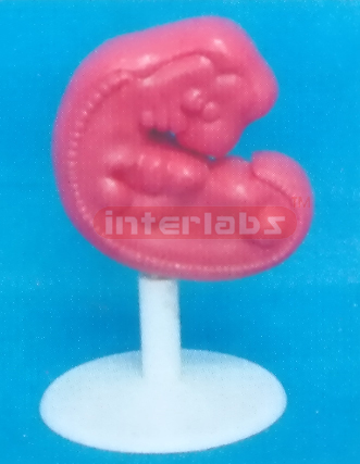 MAGNIFY HUMAN EMBRYO, ABOUT 4 WEEKS OLD