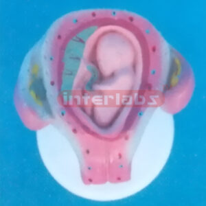 UTERUS WITH EMBRYO (3 MONTH)