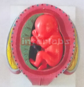 UTERUS WITH EMBRYO (6 MONTH)
