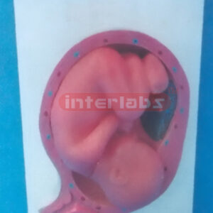 UTERUS WITH EMBRYO (9 MONTH)