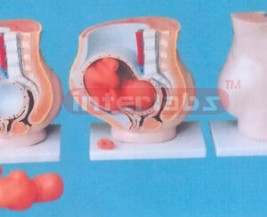 37 X 34 X 15CM GIANT SINGLE SIDE DELUXE PREGNANCY PELVIS, WITH 3-PART, (A TYPE)