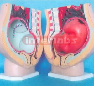 BIG LEFT SIDE PREGNANCY PELVIS MODEL WITH 3 - PARTS