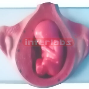 UTERUS WITH EMBRYO (4-5 MONTH)